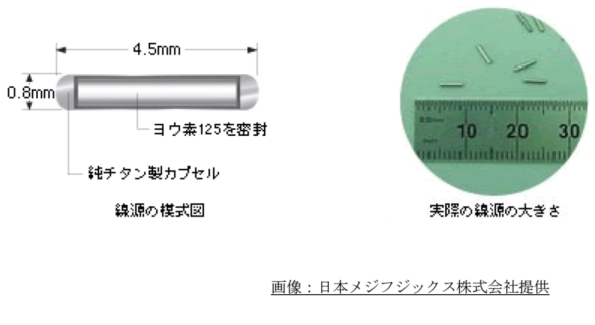前立腺がんの小線源治療はどの程度成功していますか?
